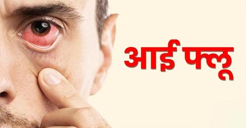 बुखार व डायरिया के बाद अब “Eye Flu” की मार, बढ़ रही मरीजों की संख्या